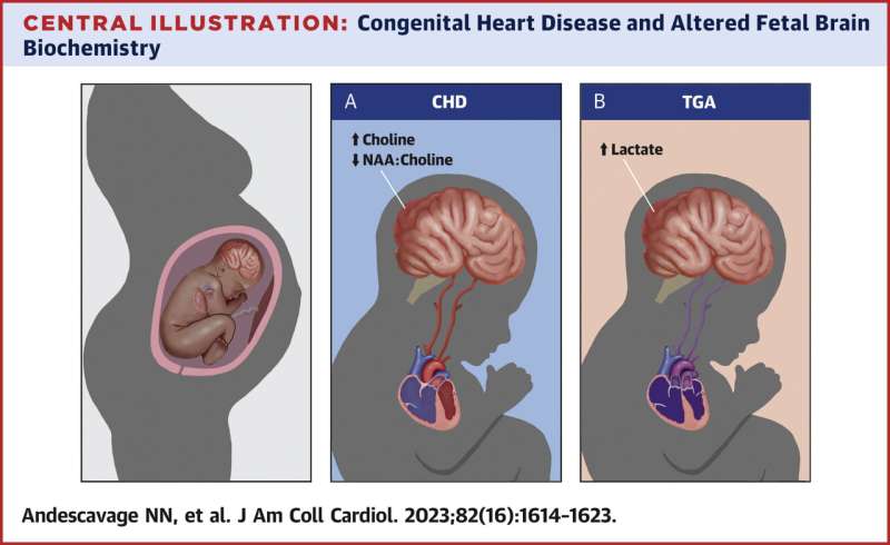 Advanced imaging reveals altered brain chemistry of babies with congenital heart disease 