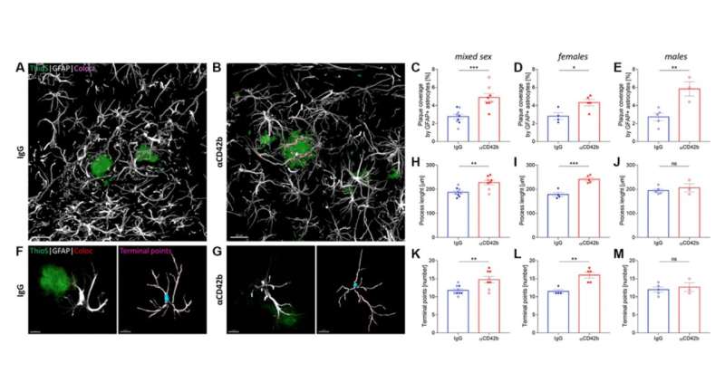 Aging | Immune-mediated platelet depletion augments Alzheimer's disease in mice