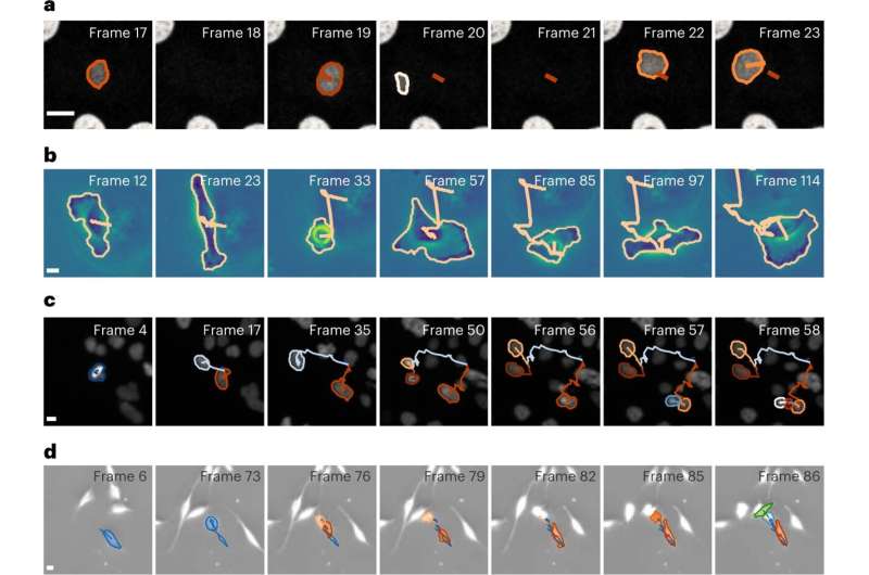 AI analyzes cell movement under the microscope