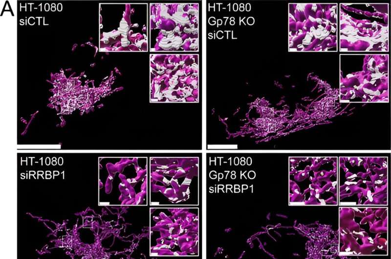 AI-driven breakthroughs in cells study: 'MCS-detect' for advancements in super-resolution microscopy