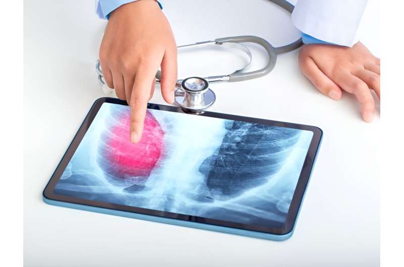 AI tool similar to radiologists for interpreting chest radiographs