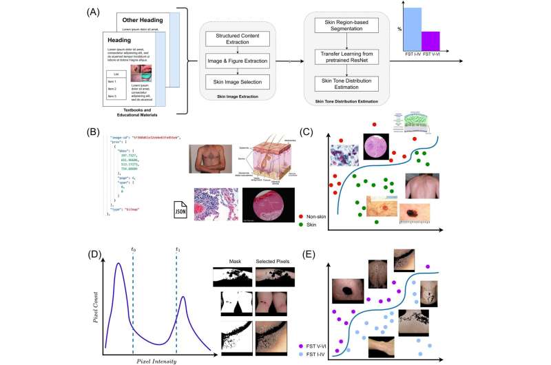 AI uncovers bias in dermatology training tools