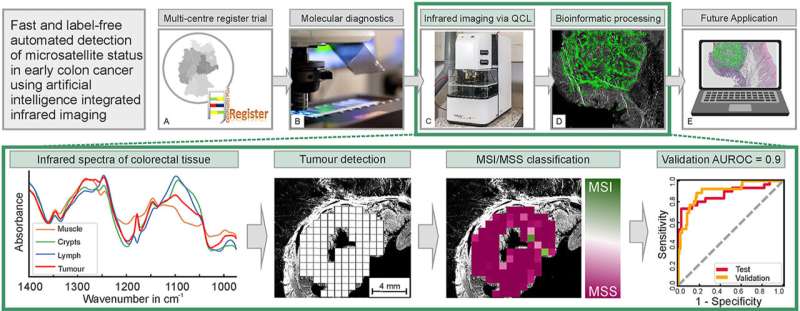 AI with infrared imaging enables precise colon cancer diagnostics