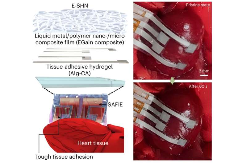 An adhesive and stretchable epicardial patch to precisely monitor the heart's activity 