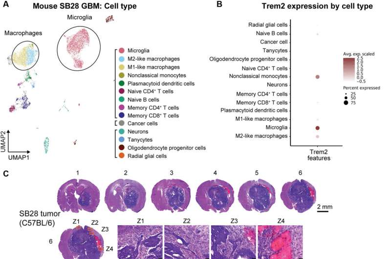 Antitumor cell activity in glioblastoma regulated by inhibiting 'triggering receptor expressed on myeloid cells 2'