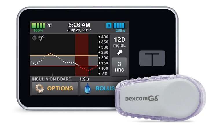 Artificial pancreas developed at UVA improves blood sugar control for kids ages 2-6, study finds