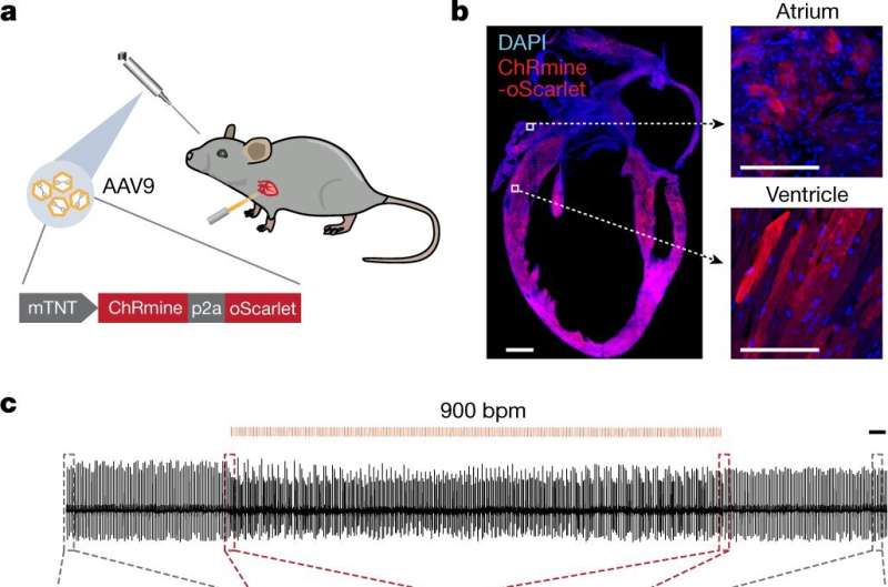 Artificially speeding up a mouse's heart rate found to increase anxiety symptoms
