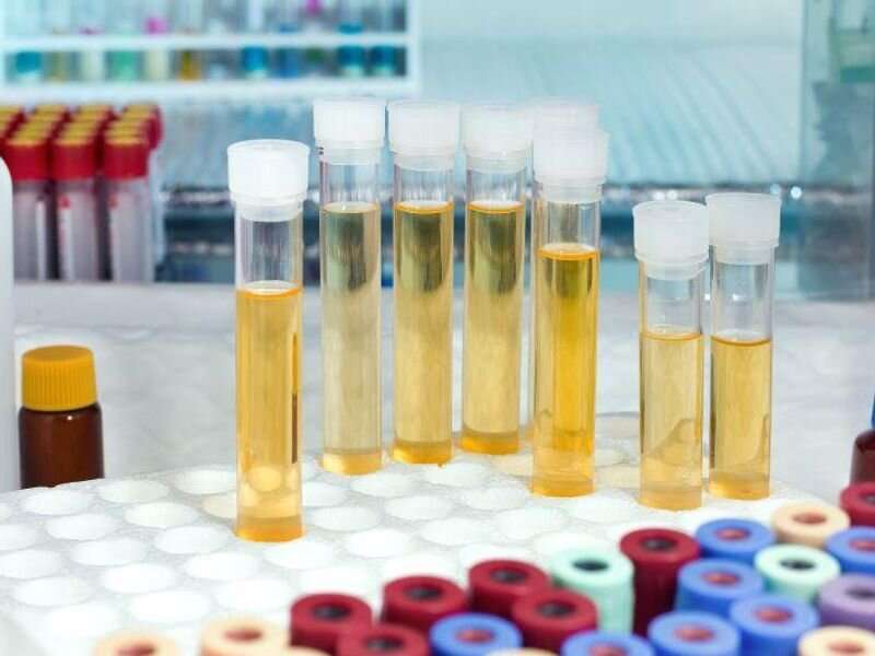 AUA: genomic urine test accurately predicts bladder cancer