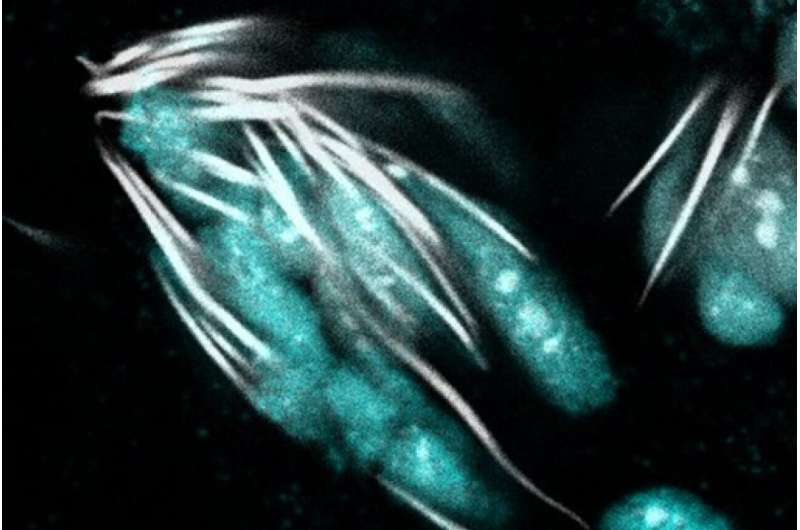 Balance between proteins keeps sperm swimming swiftly