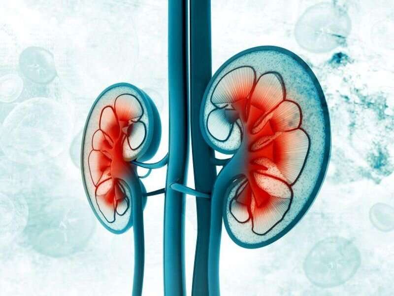 Banff automation system improves diagnosis of kidney allograft rejection