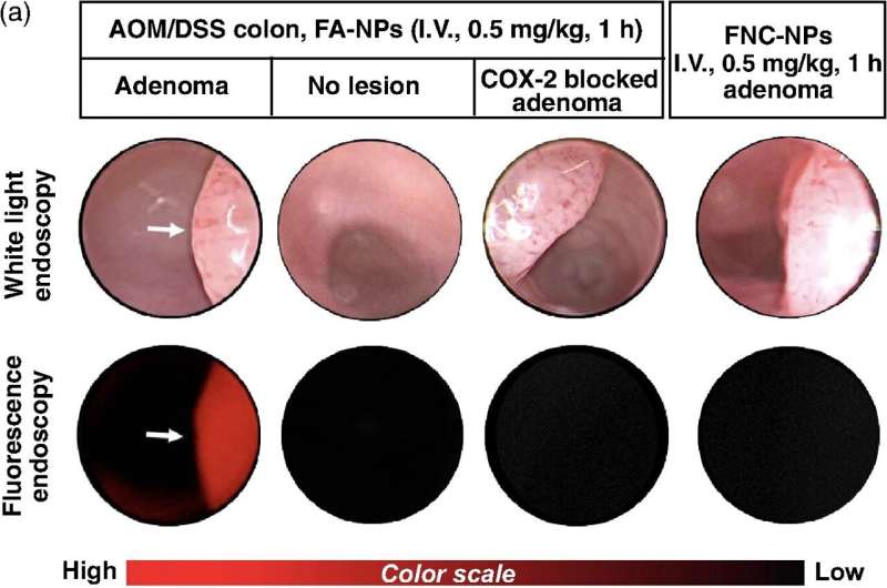 Better adenoma detection using a molecular marker for fluorescent imaging