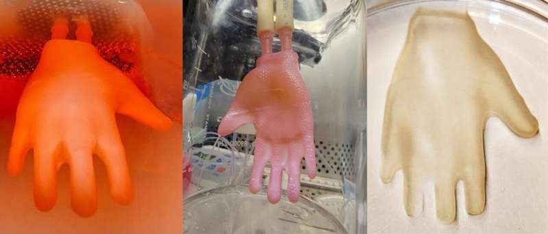 Bioengineered Skin Grafts that Fit Like Glove