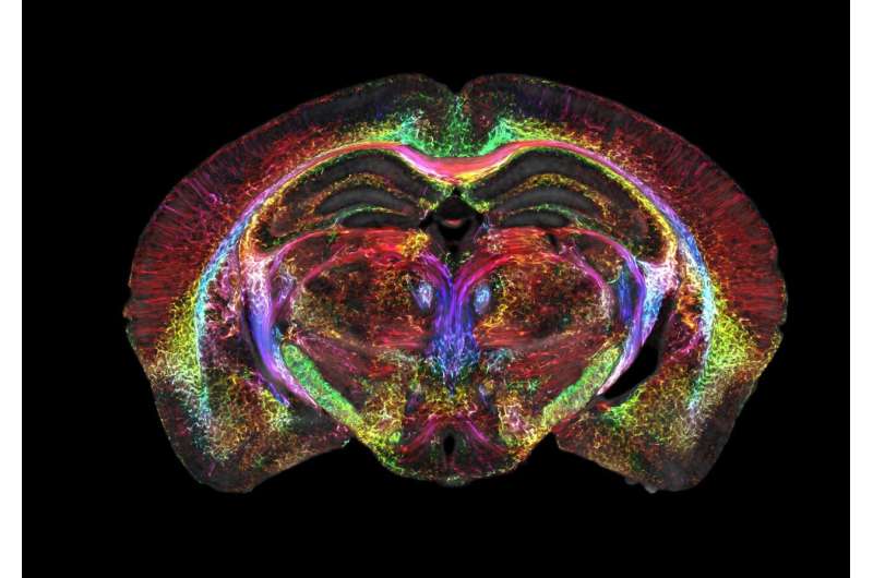 Brain images just got 64 million times sharper