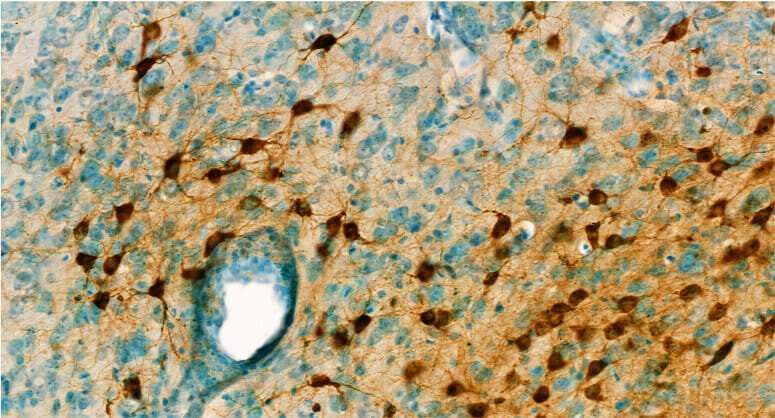 Brain-penetrating drug candidate effective against deadly encephalitis viruses