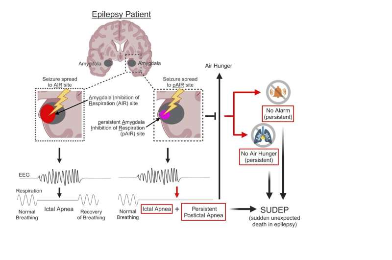 Brain regions identified that may play a role in Sudden Unexpected Death in Epilepsy