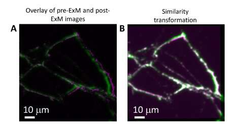 Brighter fluorescent markers allow for finer imaging