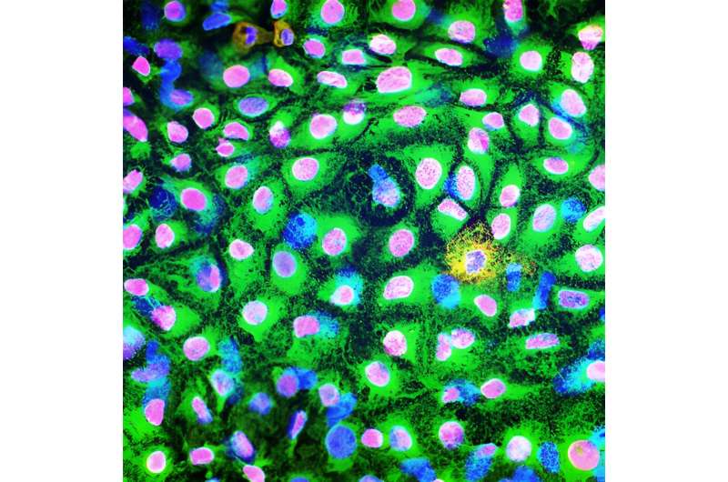 Camouflaging stem cell-derived transplants avoids immune rejection