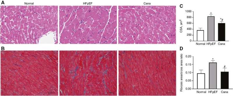 Canagliflozin regulates ferroptosis, potentially via activating AMPK/PGC-1α/Nrf2 signaling in HFpEF rats
