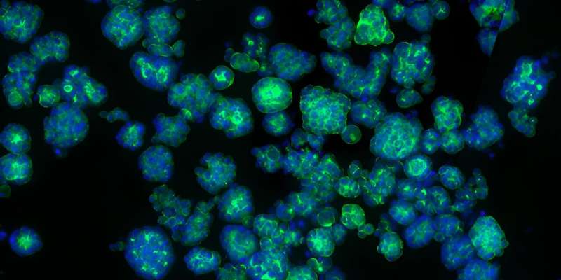 Cancer research: Metabolite drives tumor development