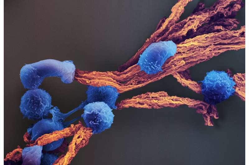 CAR-T cell cancer immunotherapy gets personal
