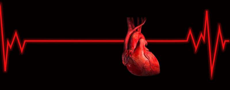 cardiac