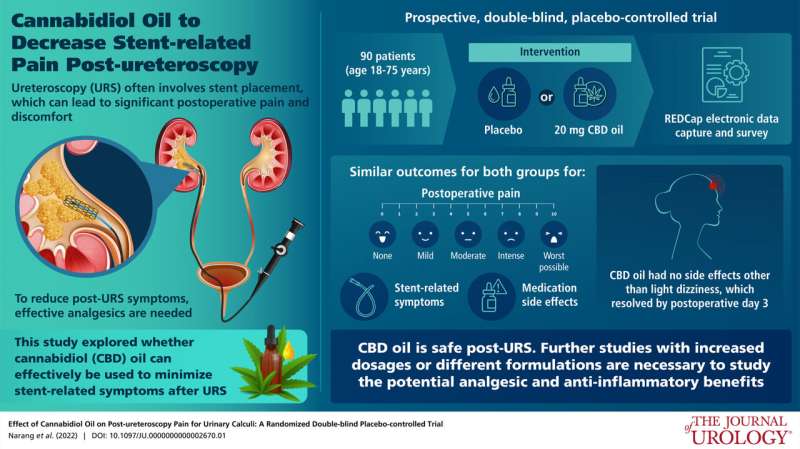 CBD oil doesn't reduce pain after common treatment for urinary stones
