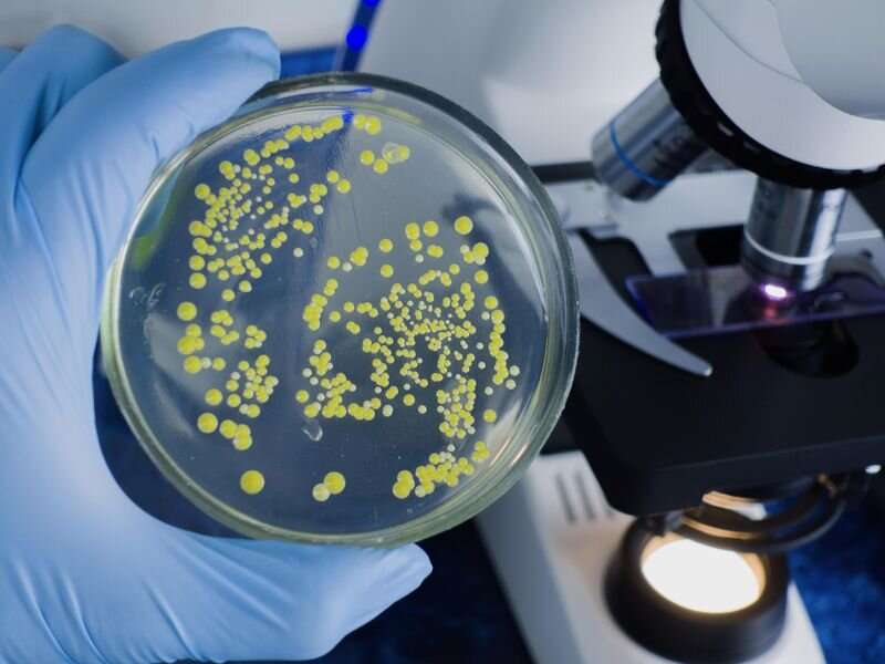 CDC warns of rise of drug-resistant shigella bacteria