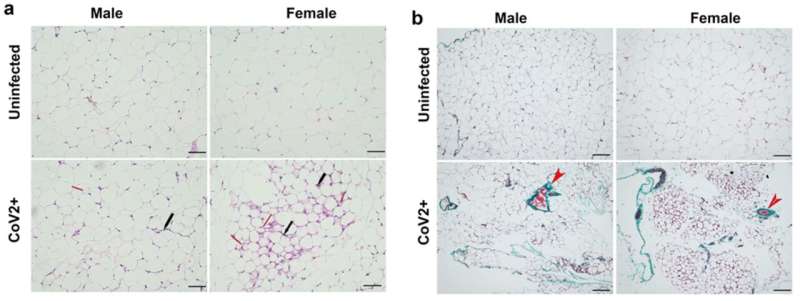 CDI researcher might have found key to why COVID-19 kills more men than women