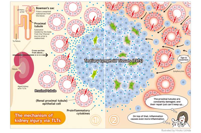 Cell interactions in abnormal structures in aged kidneys