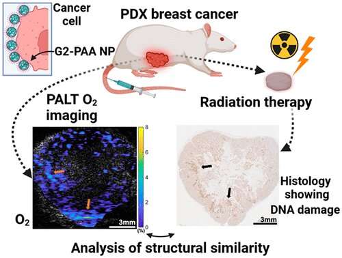 Chemical imaging could help predict efficacy of radiation therapy for an individual cancer patient