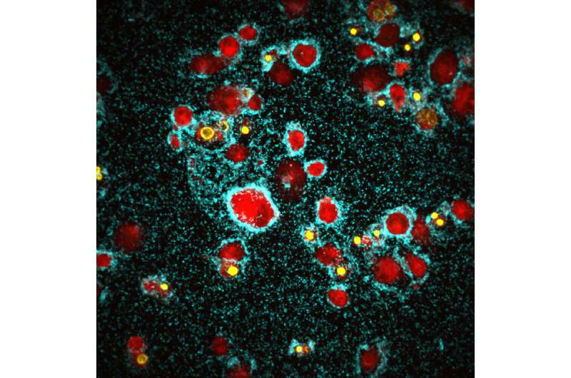 Cholera bacteria form aggressive biofilm to kill immune cells