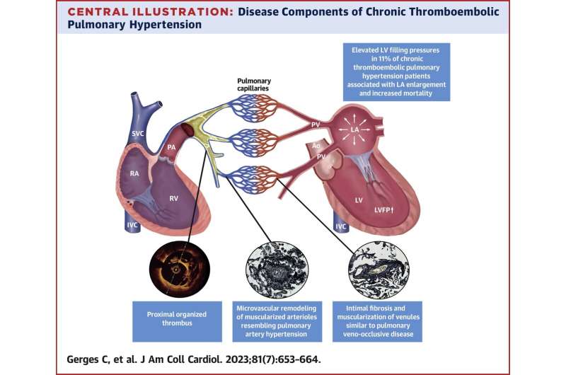 Chronic thromboembolic pulmonary vascular disease and left heart disease are not mutually exclusive