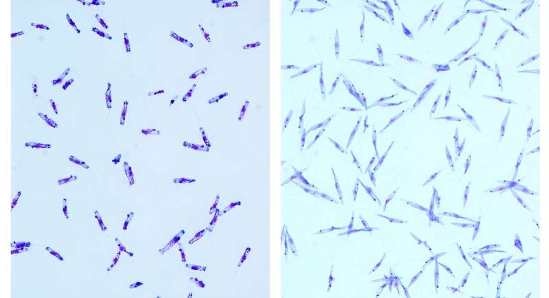 Co-infection by novel species of parasite is confirmed in visceral leishmaniasis patient
