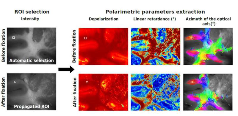 Comparing the polarimetric properties of fresh and preserved brain tissue