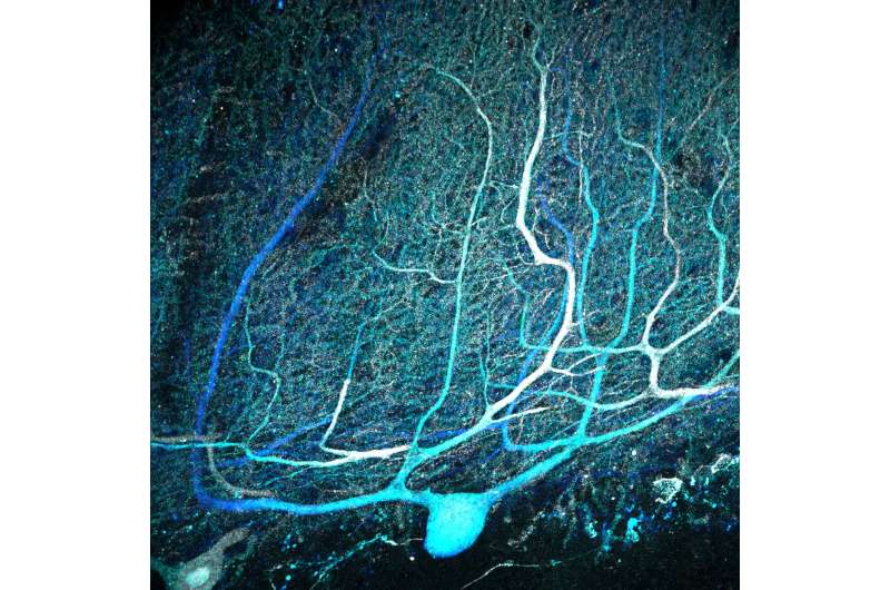 Complex brain cell connections in the cerebellum more common than believed