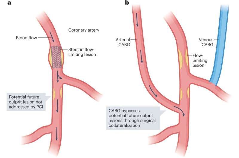 Consensus recommendations for imaging of coronary artery stenosis and atherosclerosis