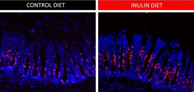 Consumption of soluble dietary fiber favors renewal of intestinal epithelial cells, study shows