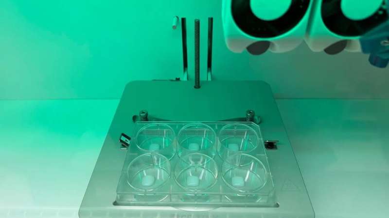 Could bioprinted skin uncover a new treatment for eczema?