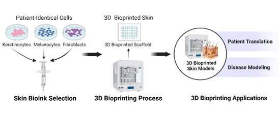 Could bioprinted skin uncover a new treatment for eczema?