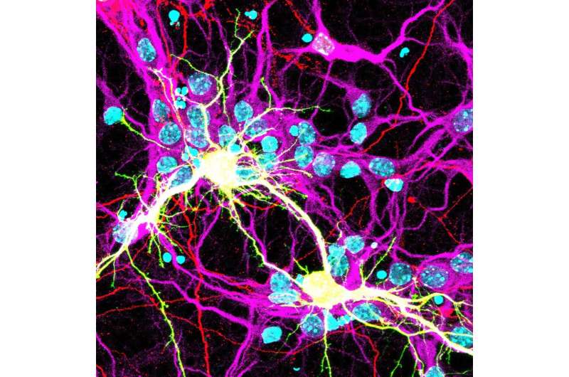 کووید-19 می تواند باعث جوش خوردن سلول های مغز شود