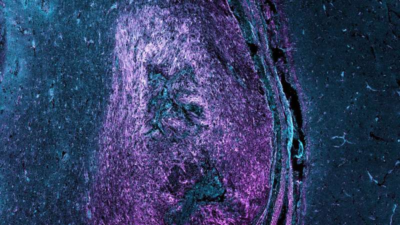 Deciphering the secrets of spinal cord regeneration protein by protein