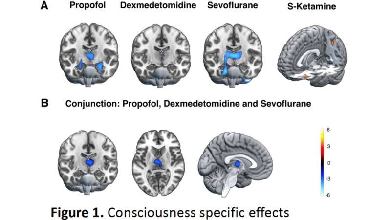 Decreased thalamic activity is a correlate for being asleep during general anesthesia – Except for ketamine