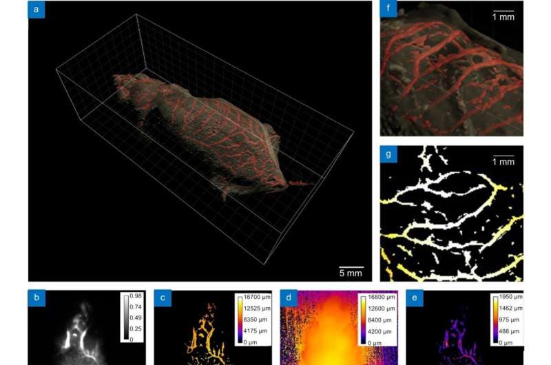 Deep learning enhanced NIR-II volumetric imaging of whole mice vasculature