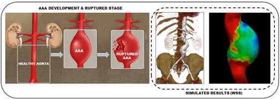 Detecting, predicting, and preventing aortic ruptures with computational modeling