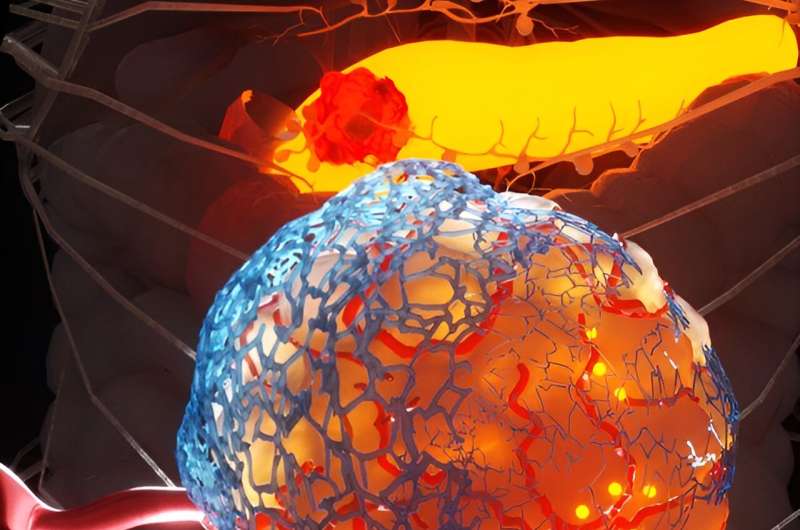 Drug that targets scar-like tissue in tumours shows promise for aggressive pancreatic cancer