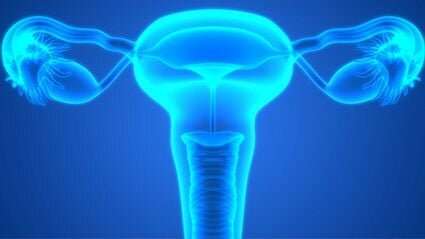 Early diagnosis of high-grade serous ovarian cancer feasible 