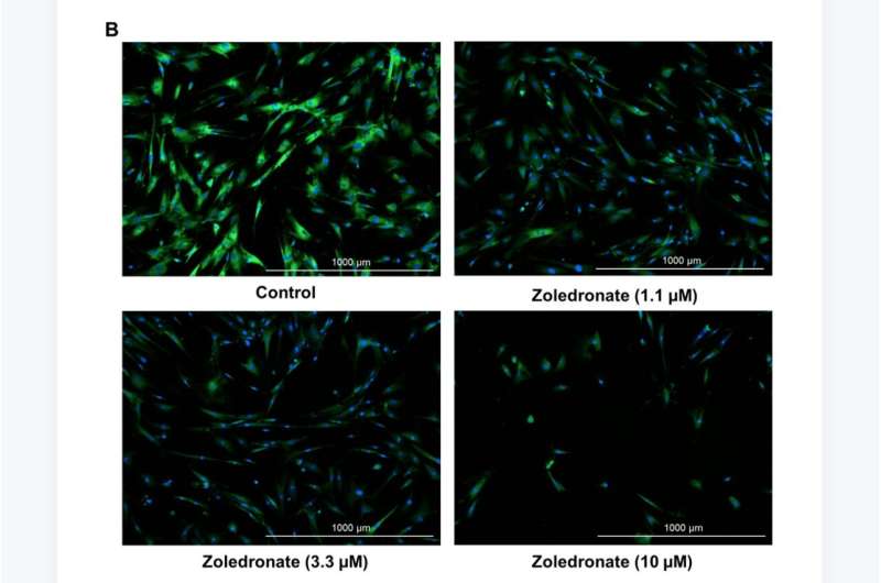 Effects of zoledronic acid on senescence and SASP markers