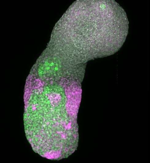 Embryoids shed light on a complex genetic mechanism