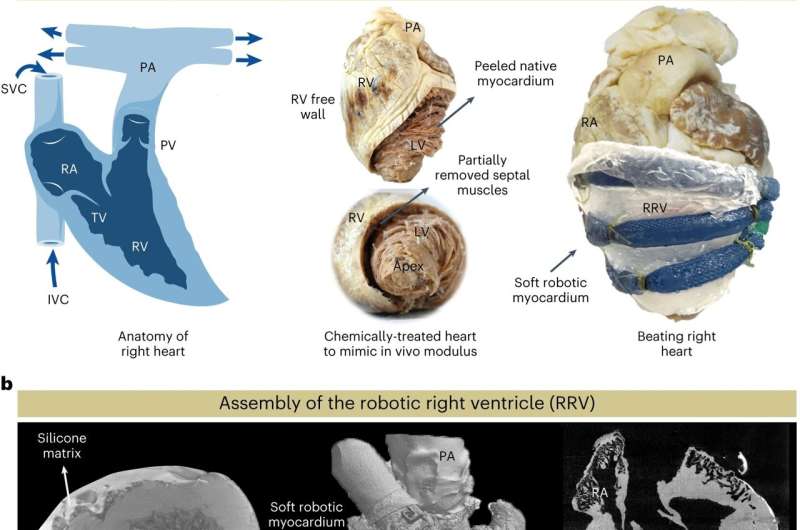 Engineers design a robotic replica of the heart's right chamber
