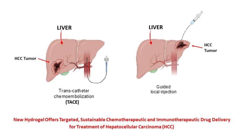 Enhanced treatment of liver carcinoma with a drug-eluting hydrogel